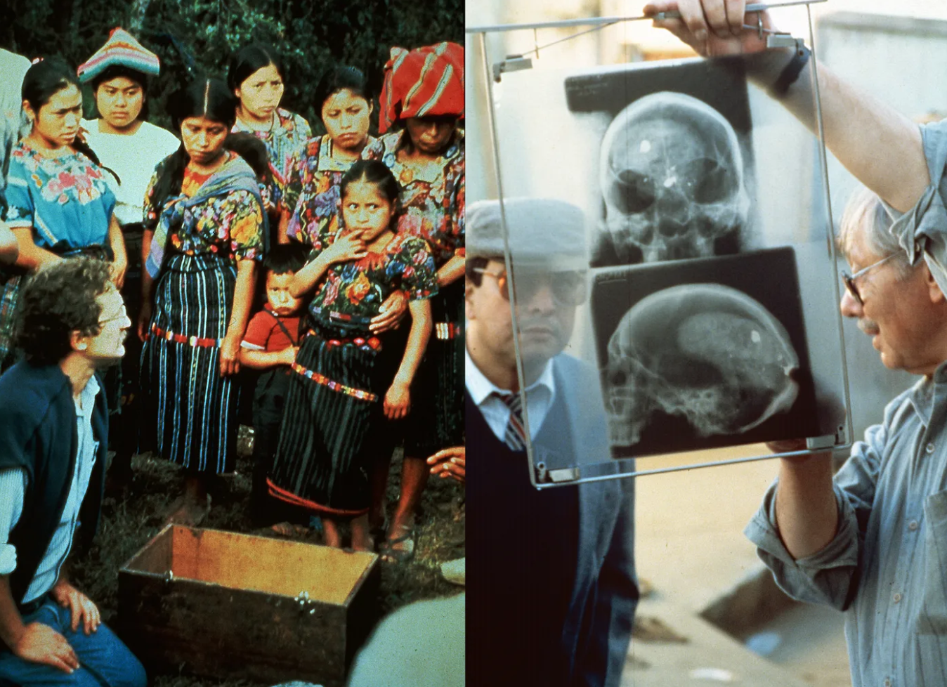 Left: Eric Stover at the first exhumation of a mass grave near Chichicastenango, Guatemala in the early 1990s. It was believed to contain the remains of villagers who had been executed by the military. He is asking permission, from family members who believe the grave contains their loved ones, to remove the remains so they can be taken to a hospital to be examined. Right: Forensic anthropologist Clyde Snow shows a Guatemalan judge bullet fragments embedded in the skull of one of the first victims exhumed from unmarked graves near Chichicastenango. Photos by Photo by Pamela Blotner & Eric Stover.